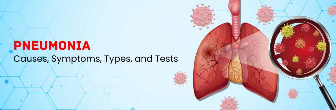 Pneumonia: Causes, Symptoms, Types, and Tests